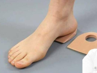 topuk dikeni nedir